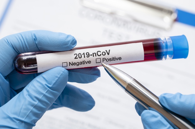 Exames de detecção do coronavírus: quais são e como funcionam