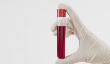Exames de sangue: Quais são os principais tipos e detecções mais comuns